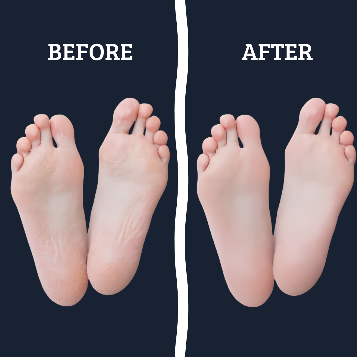 Premium Bamboo Ankle Socks